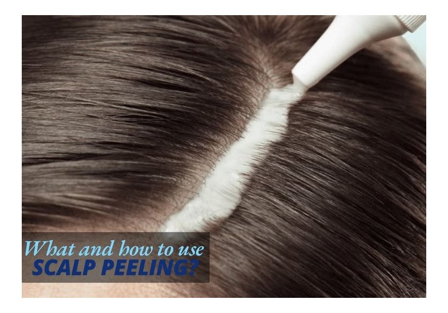 Scalp Peeling – Types, Benefits, and How to Choose the Best One.